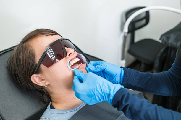 Best Knocked-Out Tooth (Avulsed Tooth) Treatment in University Heights, OH