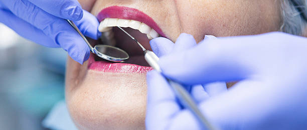 Best Emergency Root Canal Therapy in University Heights, OH